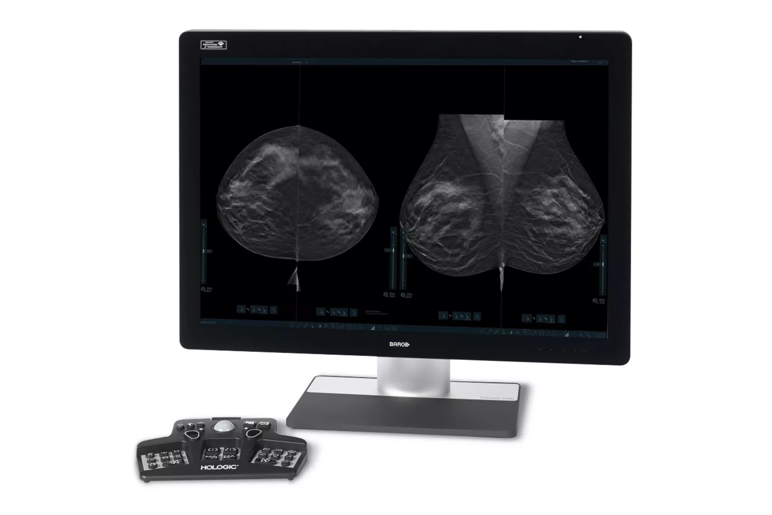 Monitor showing breast scans with controller on white background
