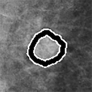 PeerViewMark1.png