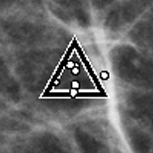 PeerViewMark2.png
