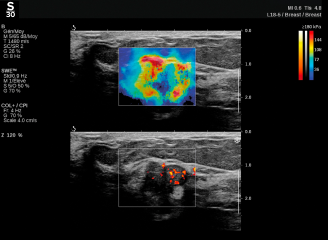 TriVu imaging