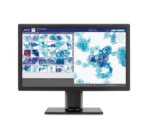 Monitor showing x-rays on white background