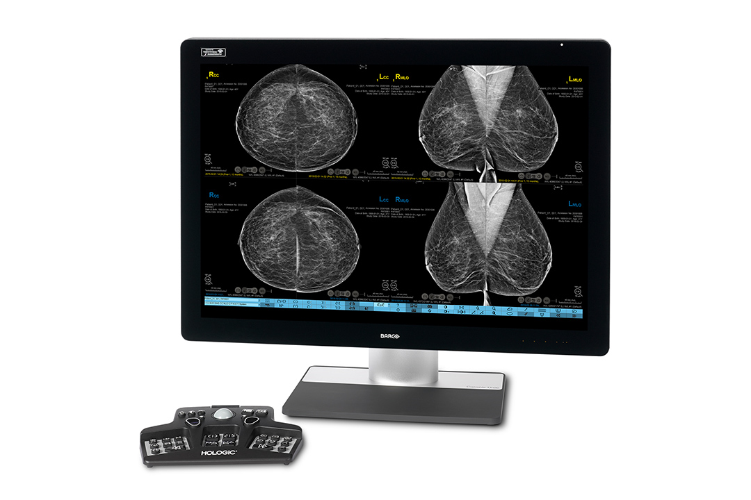 Monitor displaying mammogram images.