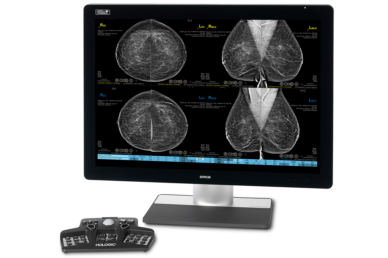 Monitor displaying mammogram images.