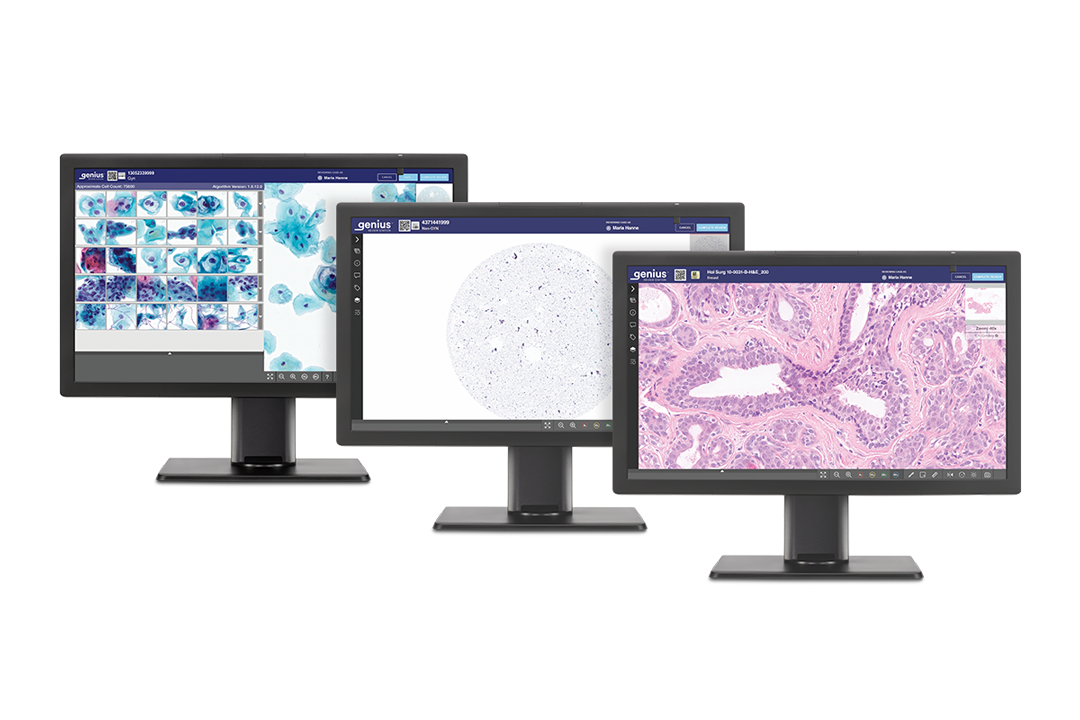Three computer screens display cell and tissue images.