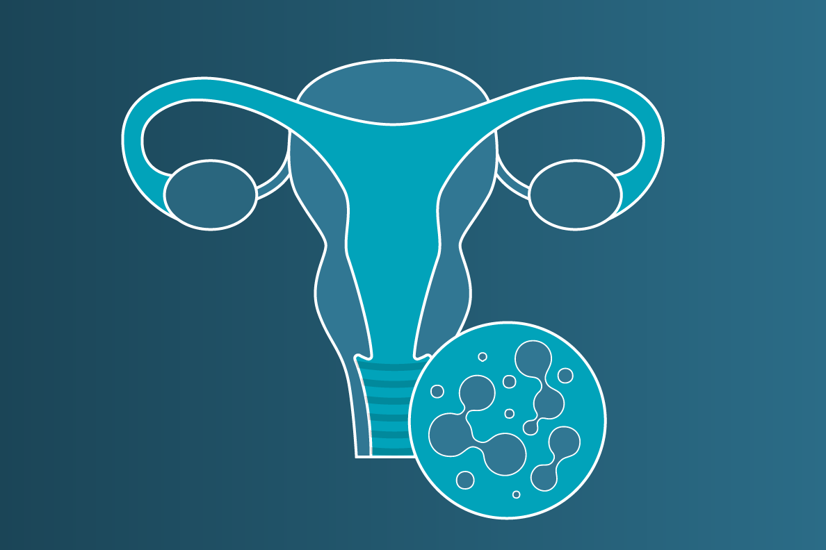 GYN Surgical Solutions