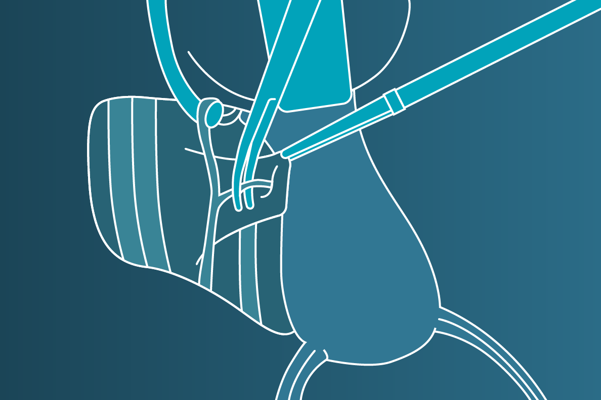 GYN Surgical Solutions 1