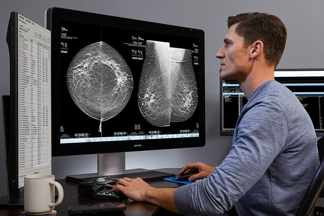 Man looks at monitor displaying mammogram images.
