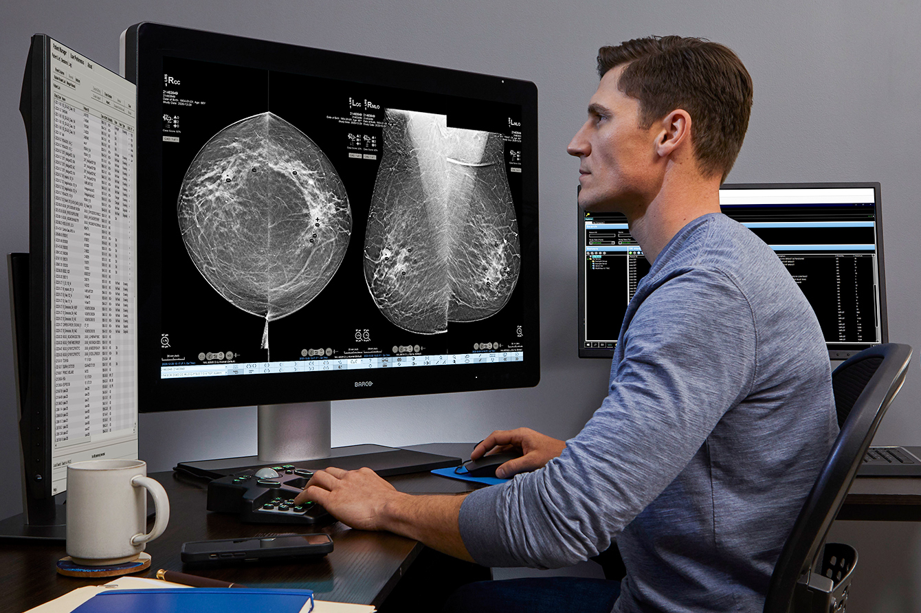 Man looking at monitor displaying mammogram images.