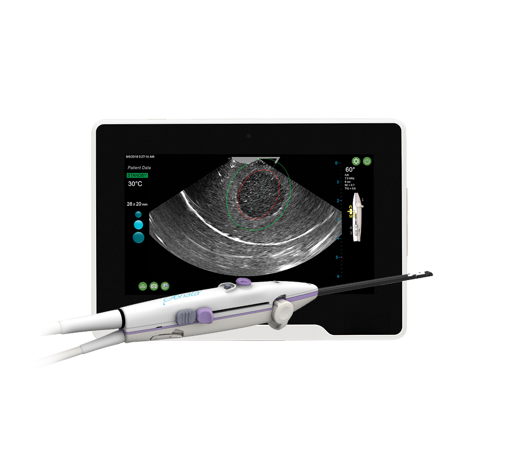 Sonata® Transcervical Fibroid Ablation System