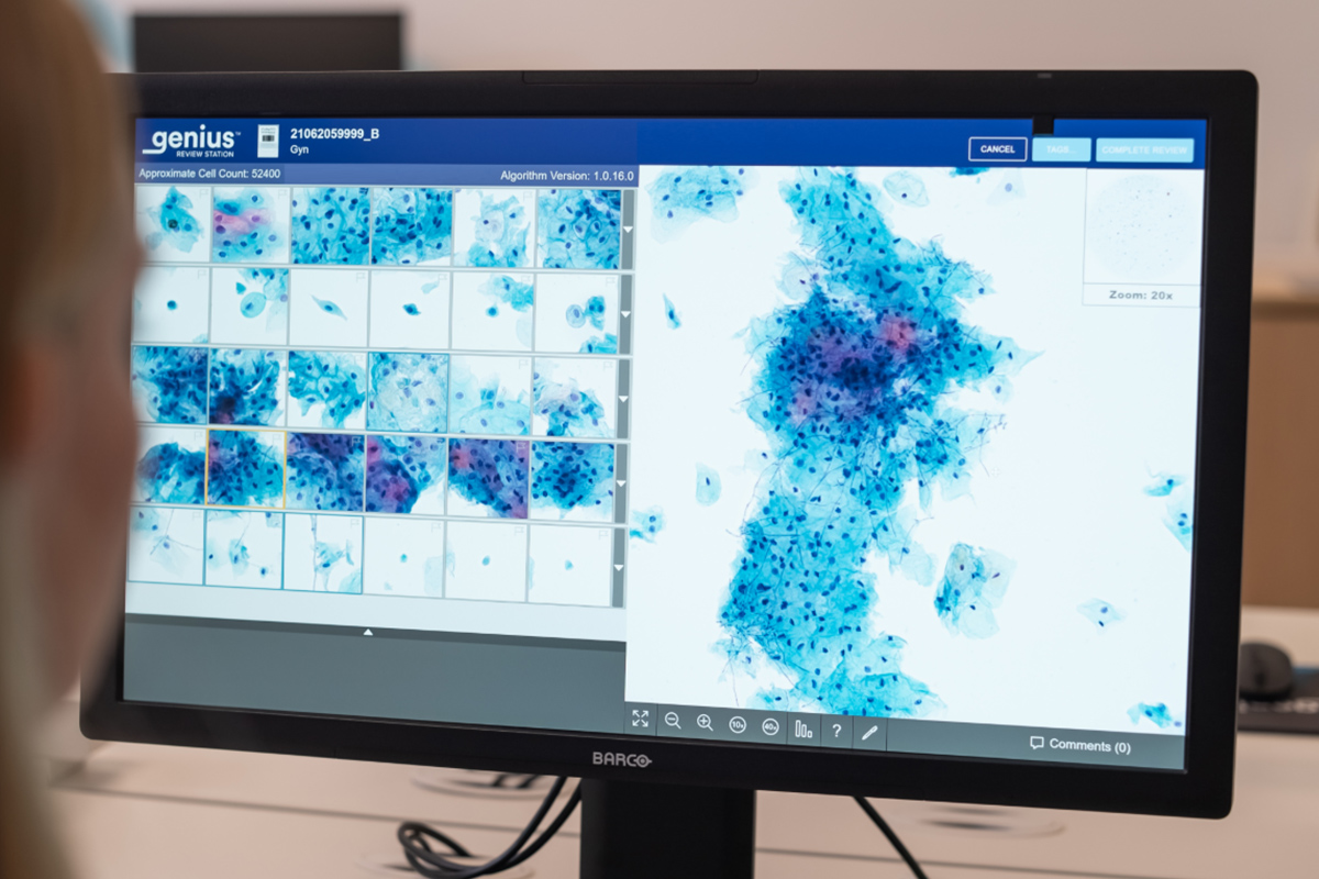 Monitor displaying images of cells.