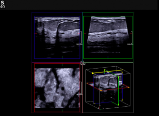 3D Breast imaging software