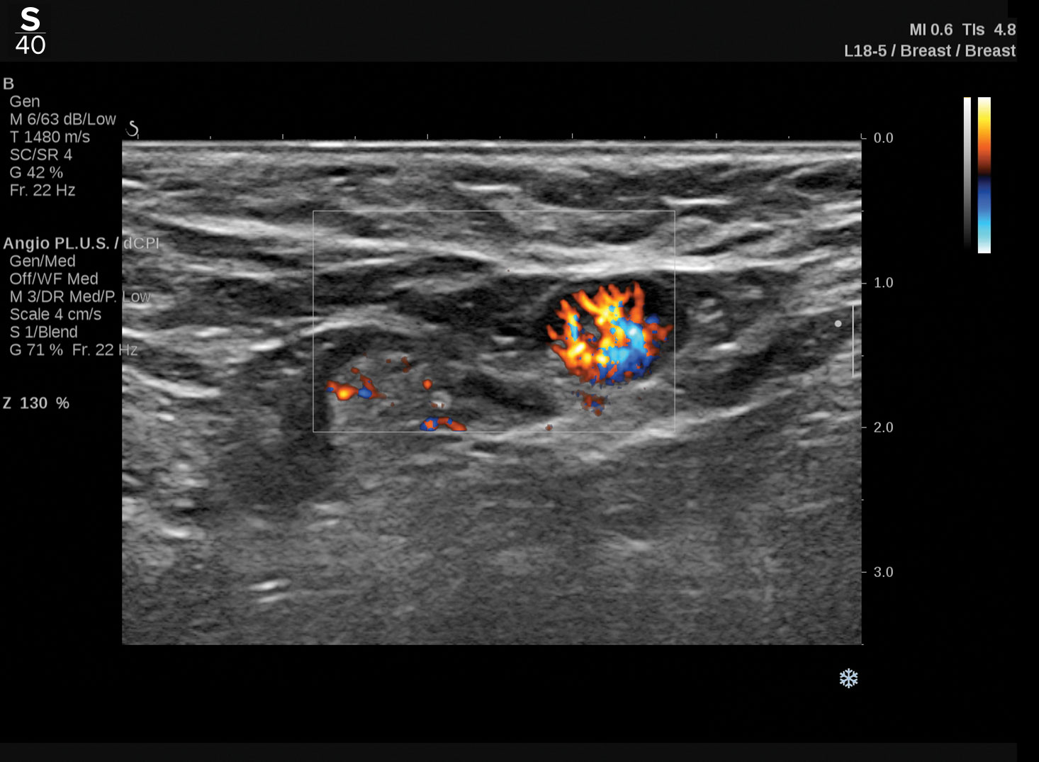 Hologic Angio PLUS clinical image