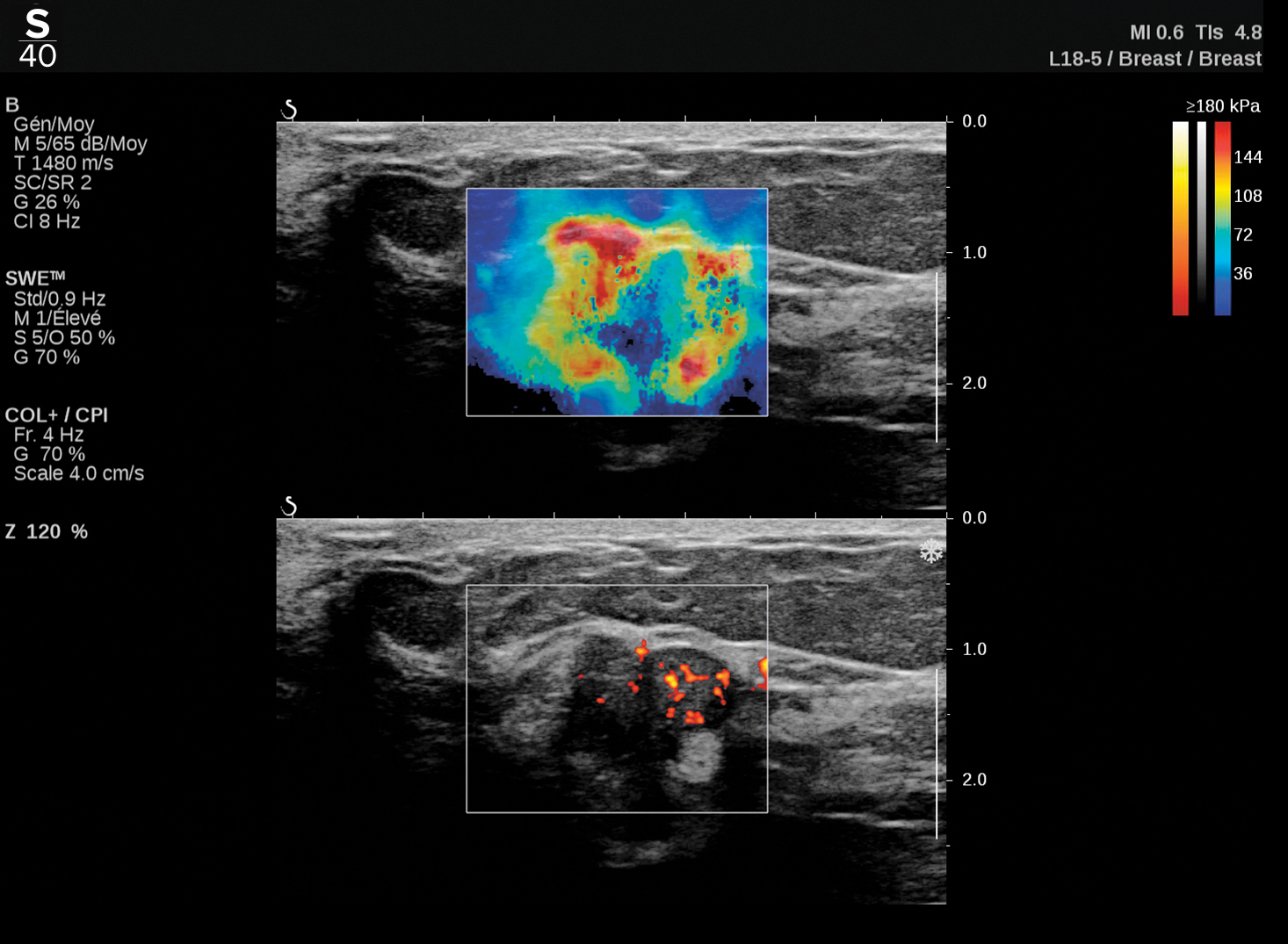 Hologic TriVu™ clinical image