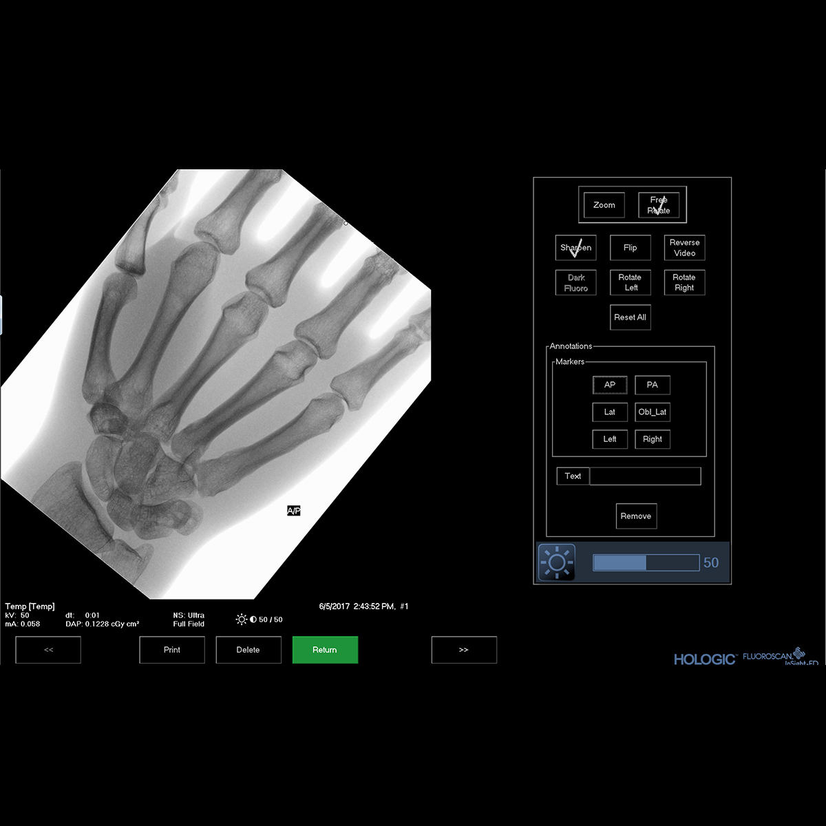 Fluoroscan® InSight® Mini Carm Extremities Imaging System Hologic