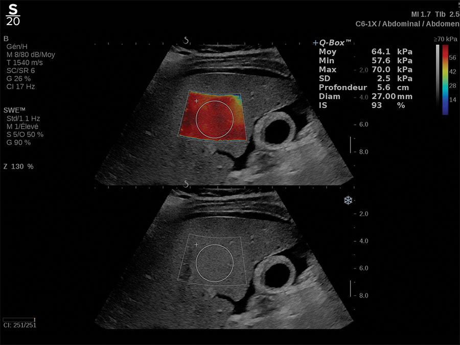 Hologic Angio PLUS clinical image