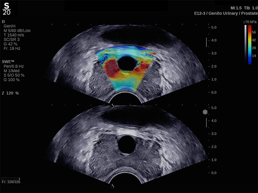 Hologic TriVu™ clinical image