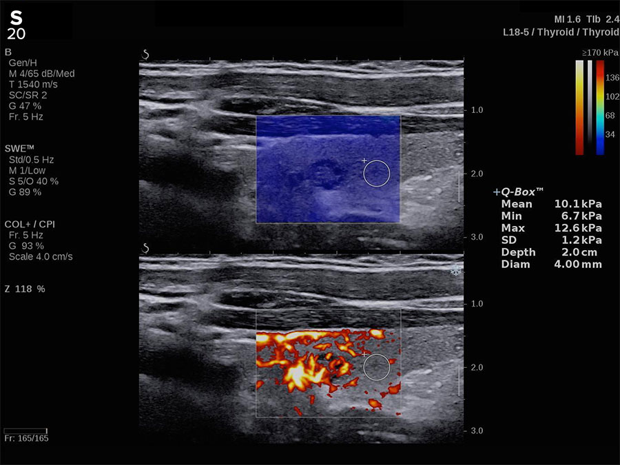 Hologic Angio PLUS clinical image