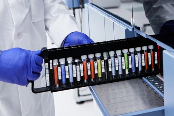 Technician placing vial rack into testing machine in lab setting.