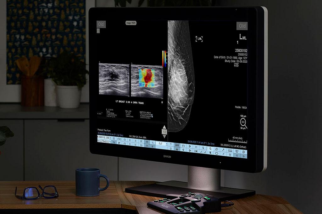 Monitor showing x-rays on desk in an office setting.