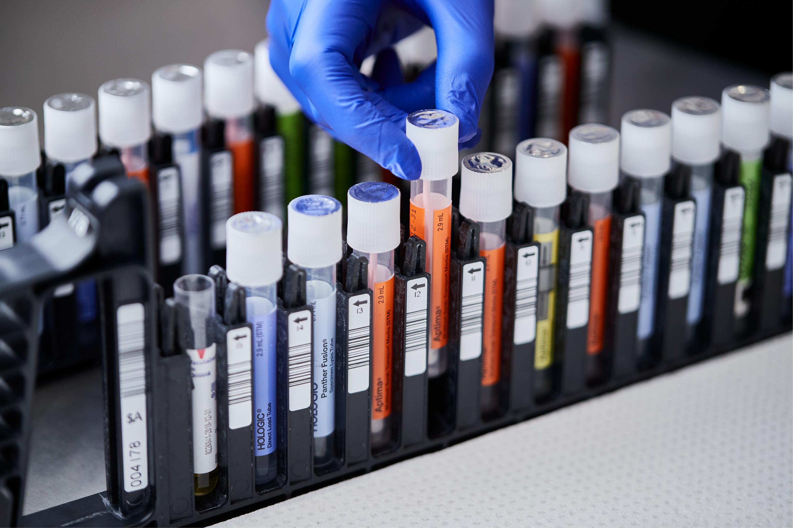 Diagnostic Collection Devices and Transfer Tubes | Hologic