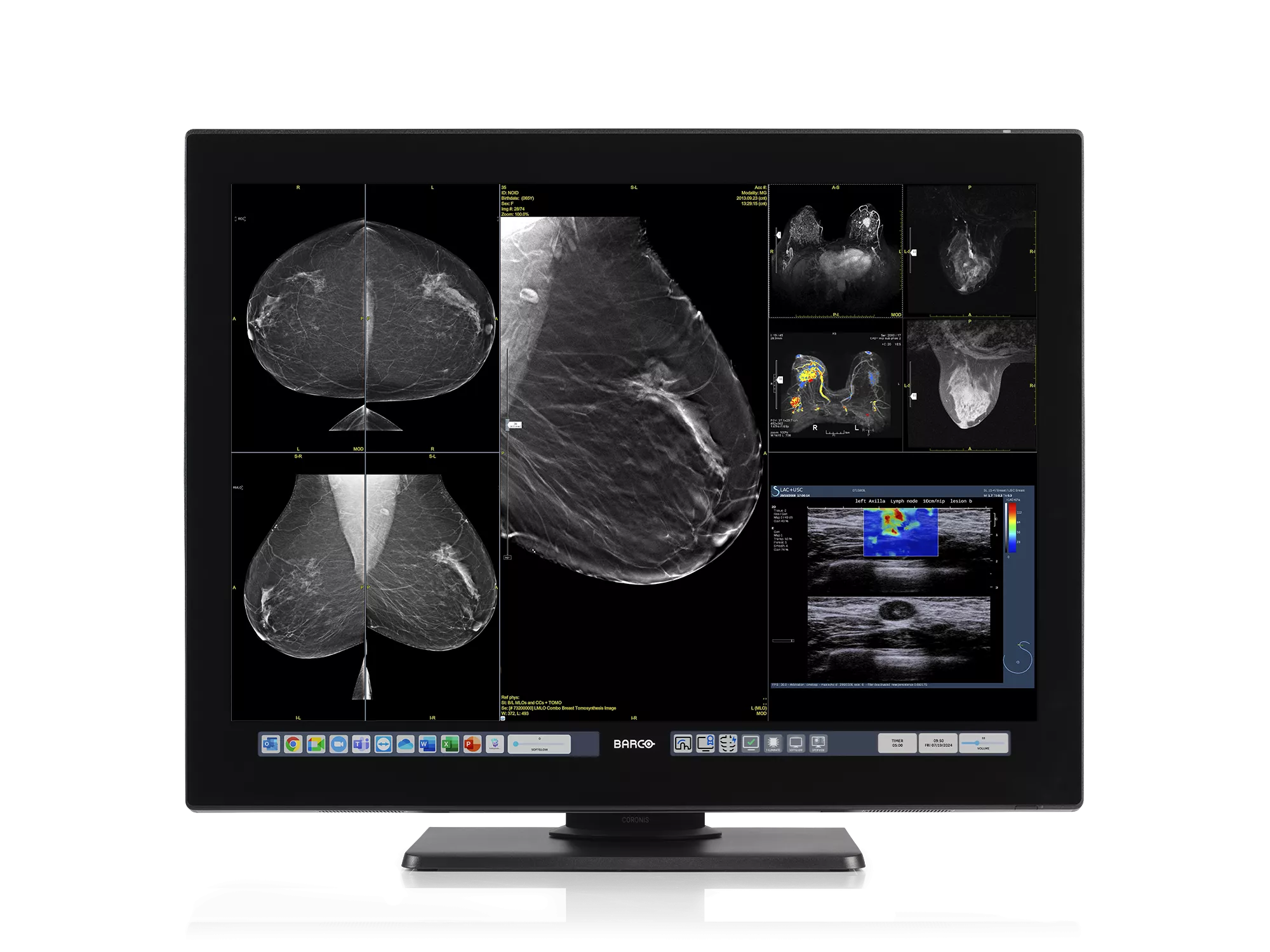 Illustration of monitor displaying x-rays