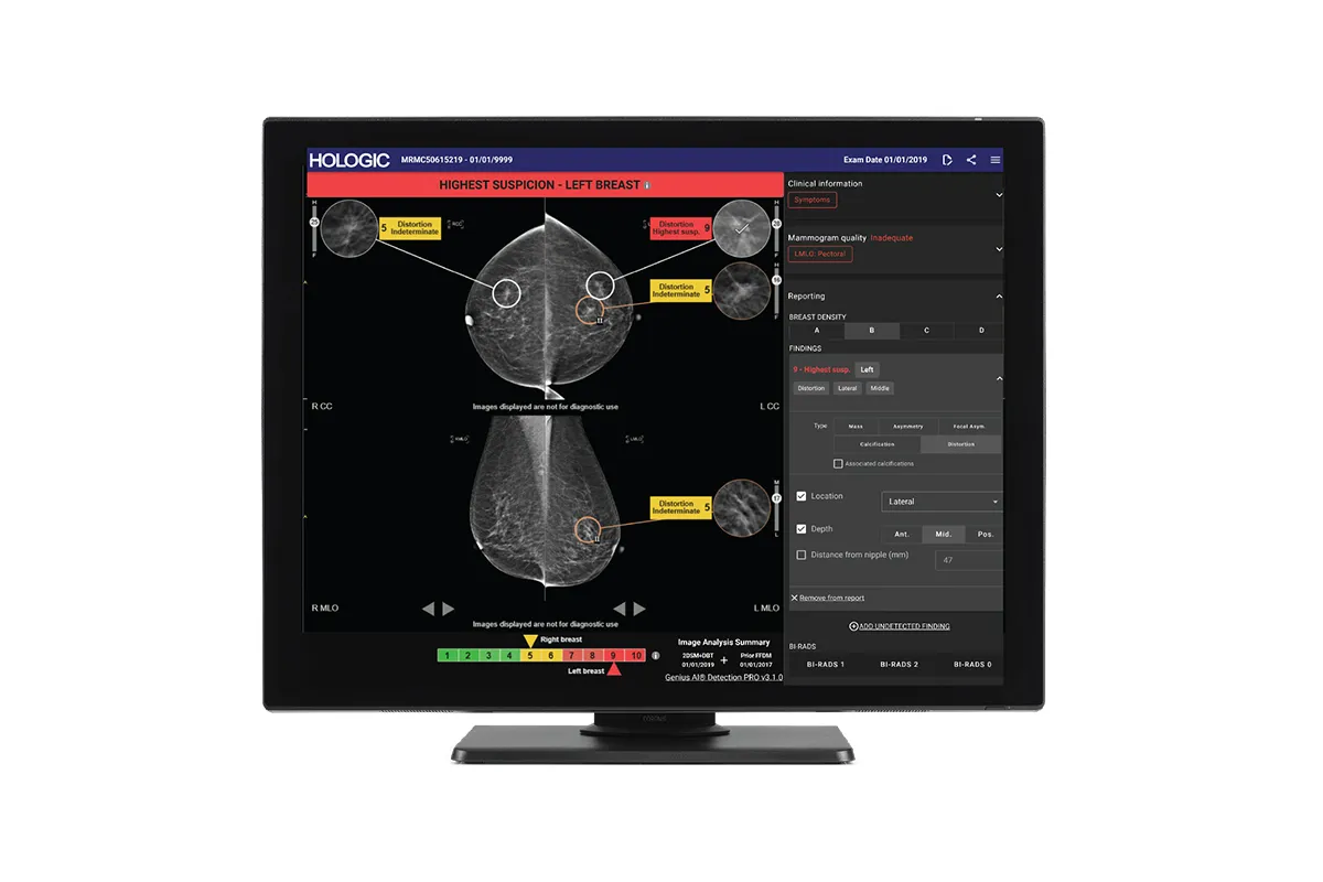 Women pointing at a AI screen