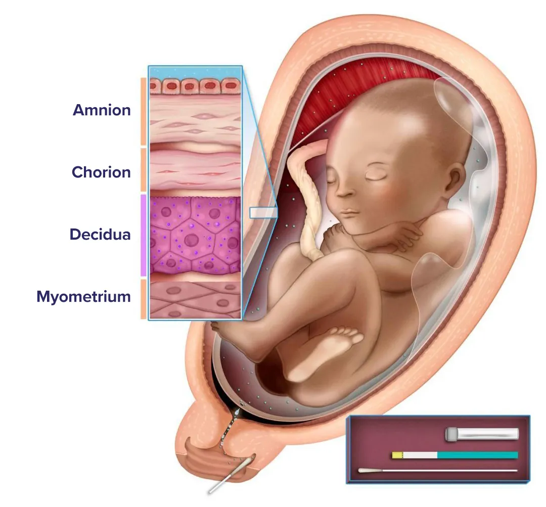 Illustration of baby in womb with data points.