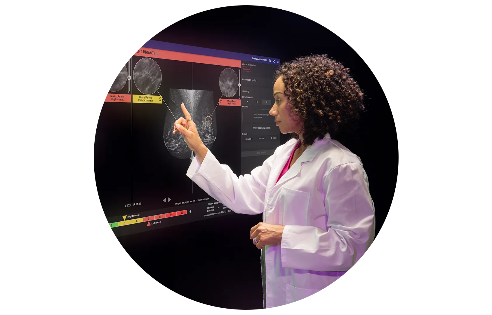 Breast Cancer Survivors