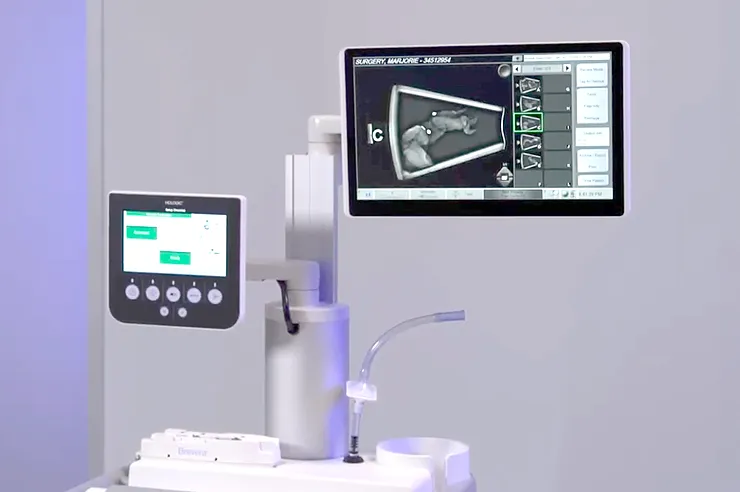 Photo of medical equipment with keypad and monitor displaying scans in a lab setting.