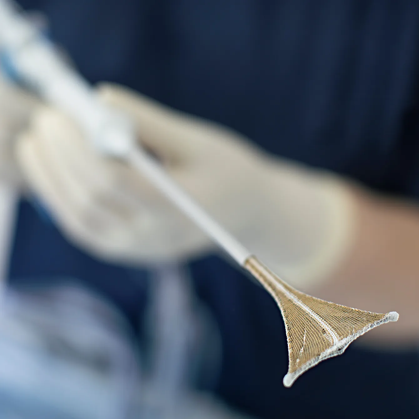 NovaSure in technician hand