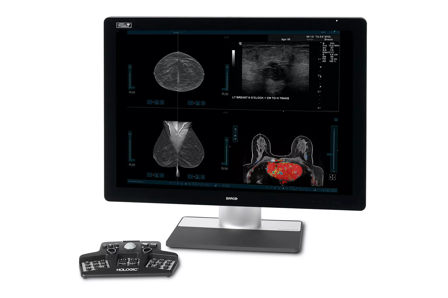 Monitor with Unifi analytics on the screen