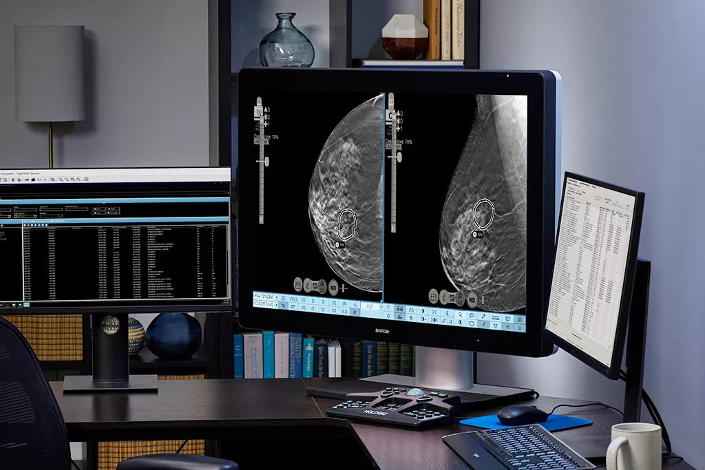 Monitor showing x-rays on a desk in an office setting.