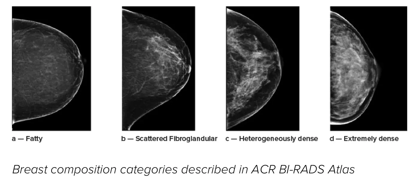 Breast imaging scans