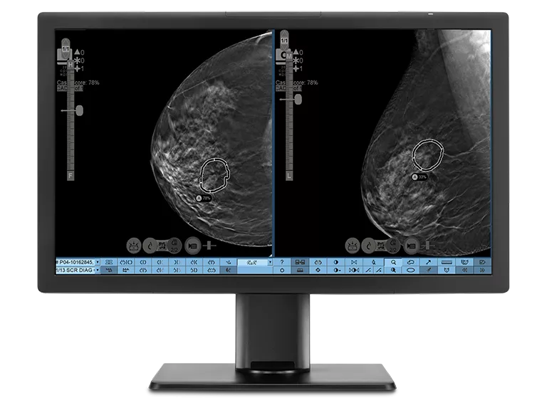 Monitor displaying x-ray images.