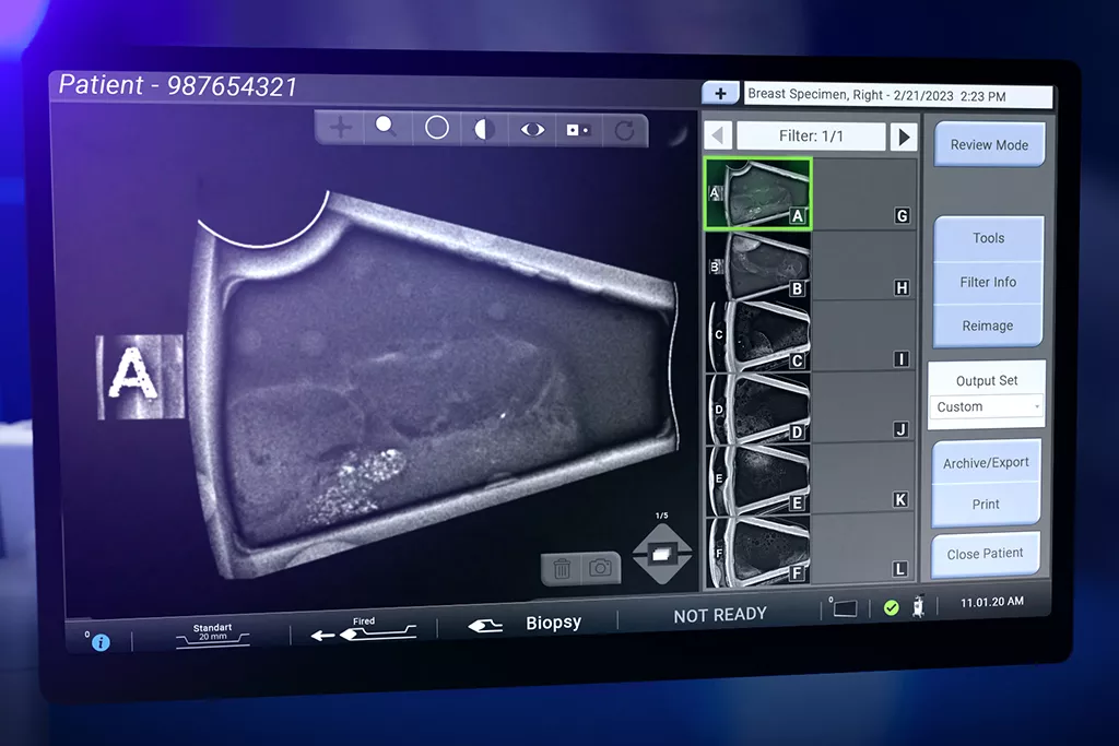 Brevera Biopsy System Screen