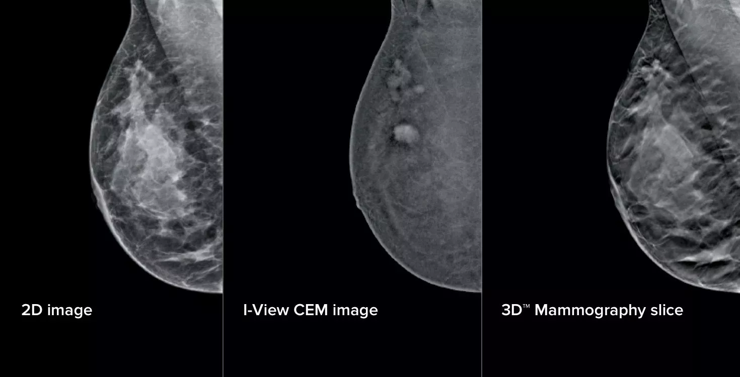 Three different x-ray images