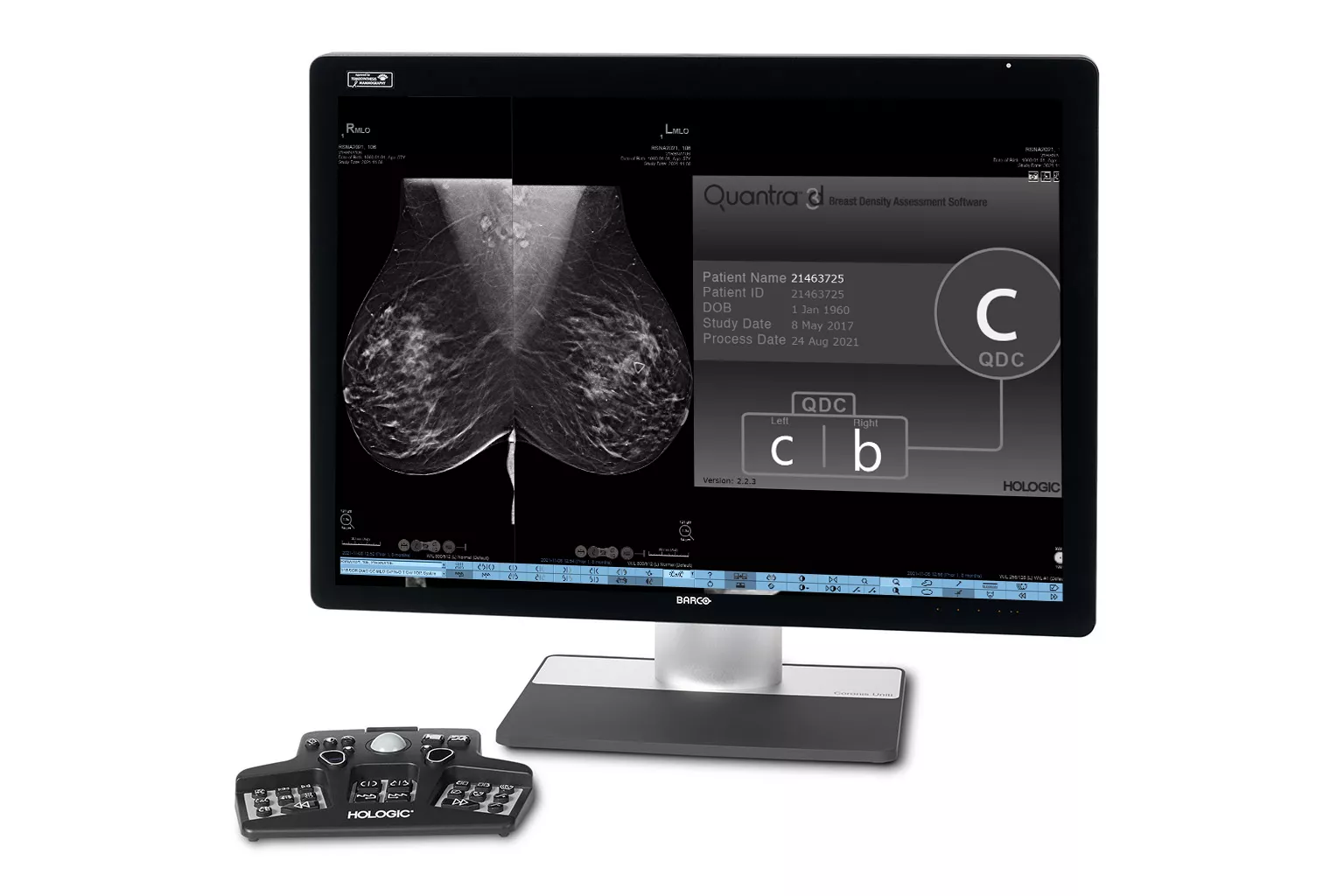 Close up image of monitor showing measurements and data