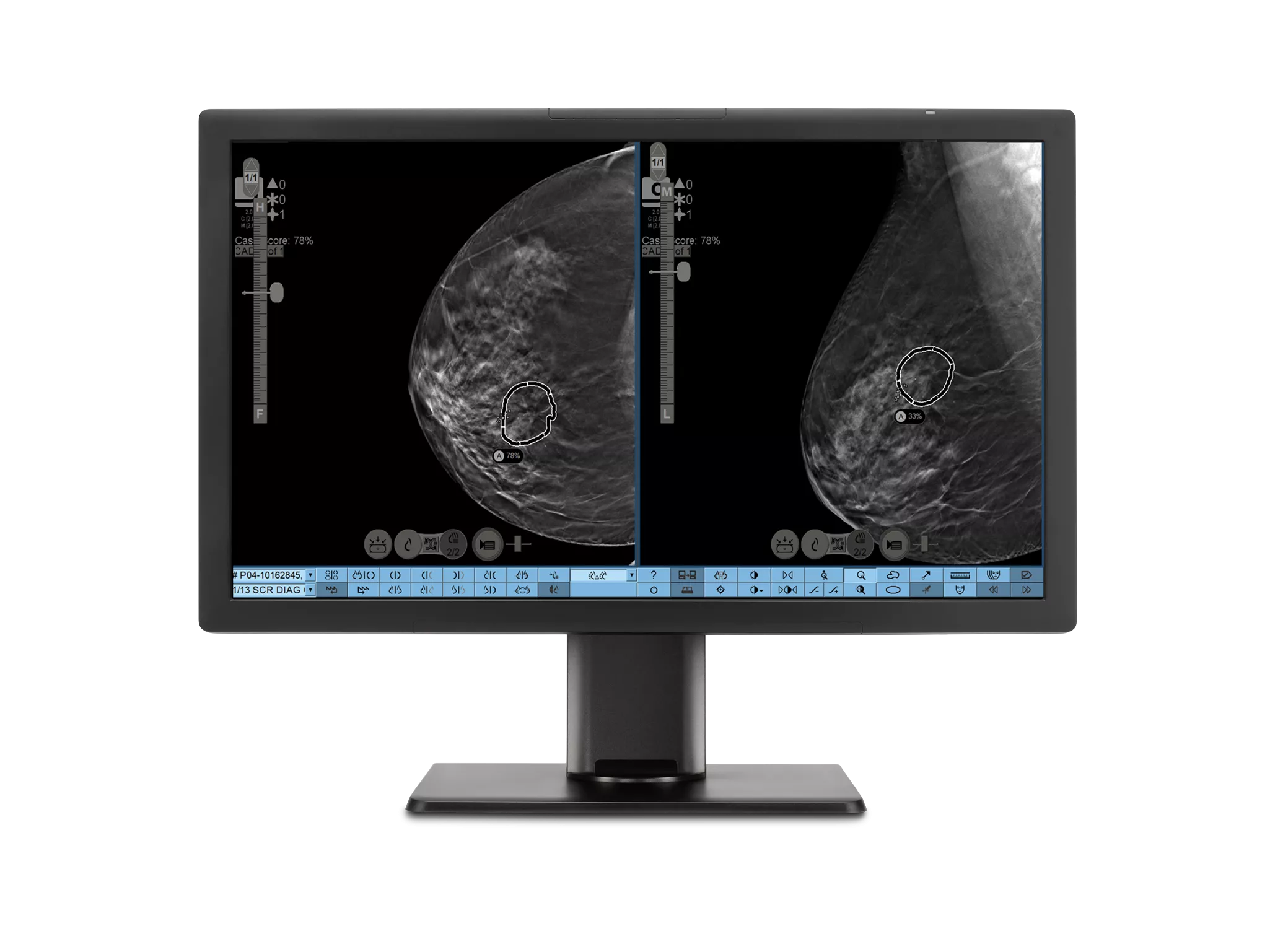 Monitor display showing x-ray images on white background