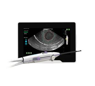 Sonata® Transcervical Fibroid Ablation System