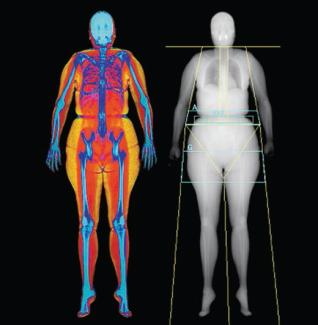 Hologic Horizon Body Composition (female)