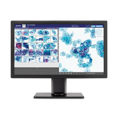 Monitor showing x-rays on white background